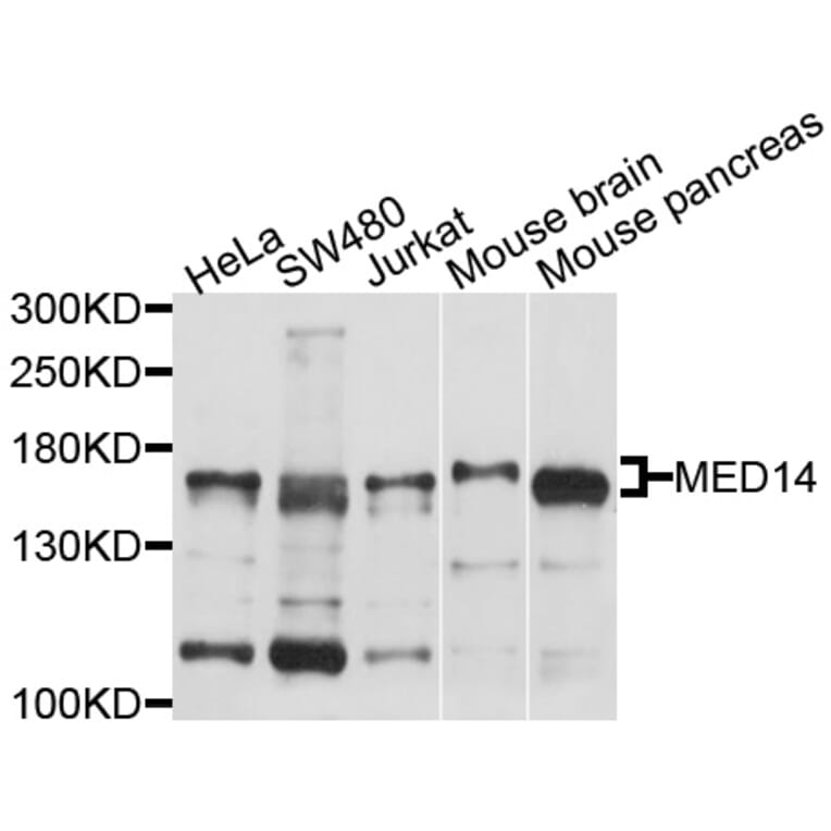 Western Blot - Anti-MED14 Antibody (A10455) - Antibodies.com