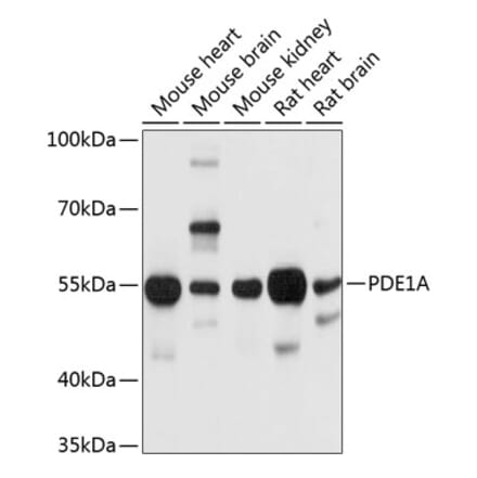 Western Blot - Anti-PDE1A Antibody (A12947) - Antibodies.com