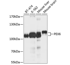 Western Blot - Anti-PEX6 Antibody (A12948) - Antibodies.com
