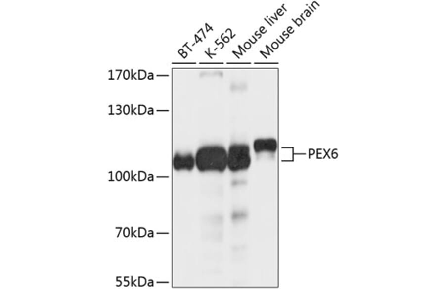 Western Blot - Anti-PEX6 Antibody (A12948) - Antibodies.com