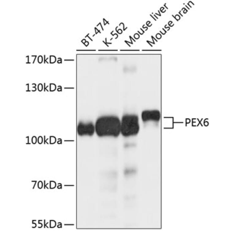 Western Blot - Anti-PEX6 Antibody (A12948) - Antibodies.com