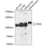 Western Blot - Anti-PEX6 Antibody (A12948) - Antibodies.com