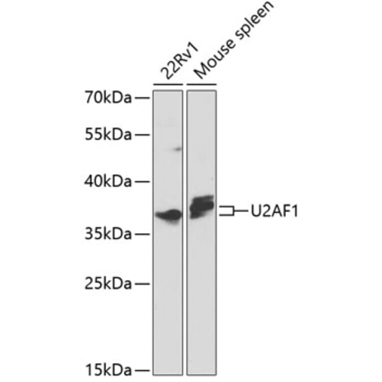 Western Blot - Anti-U2AF35 / U2AF1 Antibody (A12949) - Antibodies.com