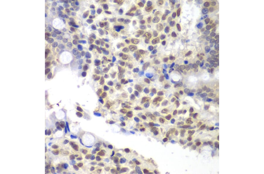 Immunohistochemistry - Anti-U2AF35 / U2AF1 Antibody (A12949) - Antibodies.com