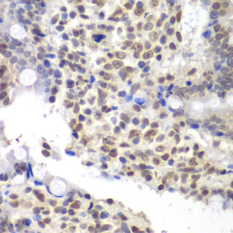 Immunohistochemistry - Anti-U2AF35 / U2AF1 Antibody (A12949) - Antibodies.com