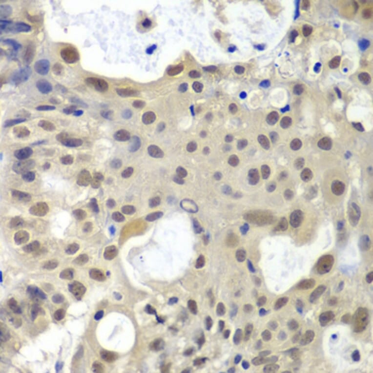 Immunohistochemistry - Anti-U2AF35 / U2AF1 Antibody (A12949) - Antibodies.com