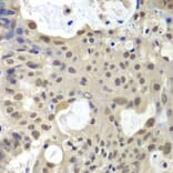 Immunohistochemistry - Anti-U2AF35 / U2AF1 Antibody (A12949) - Antibodies.com