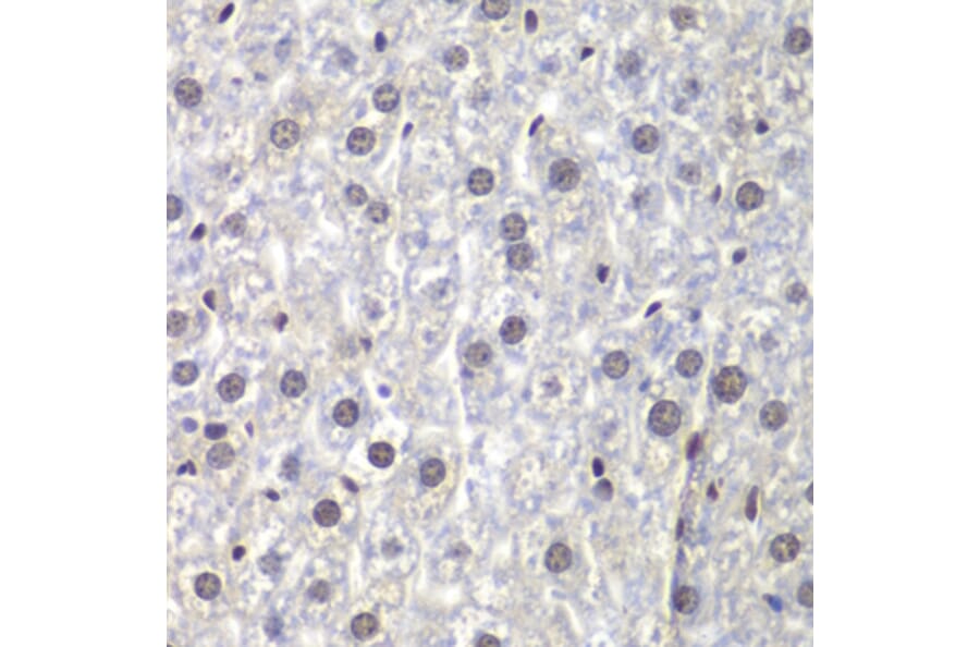 Immunohistochemistry - Anti-U2AF35 / U2AF1 Antibody (A12949) - Antibodies.com
