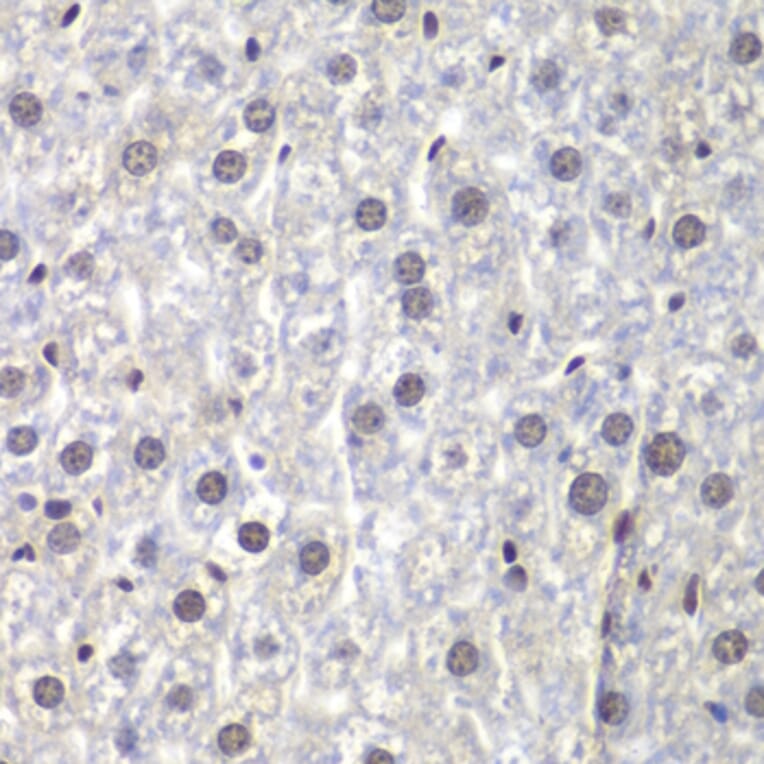 Immunohistochemistry - Anti-U2AF35 / U2AF1 Antibody (A12949) - Antibodies.com