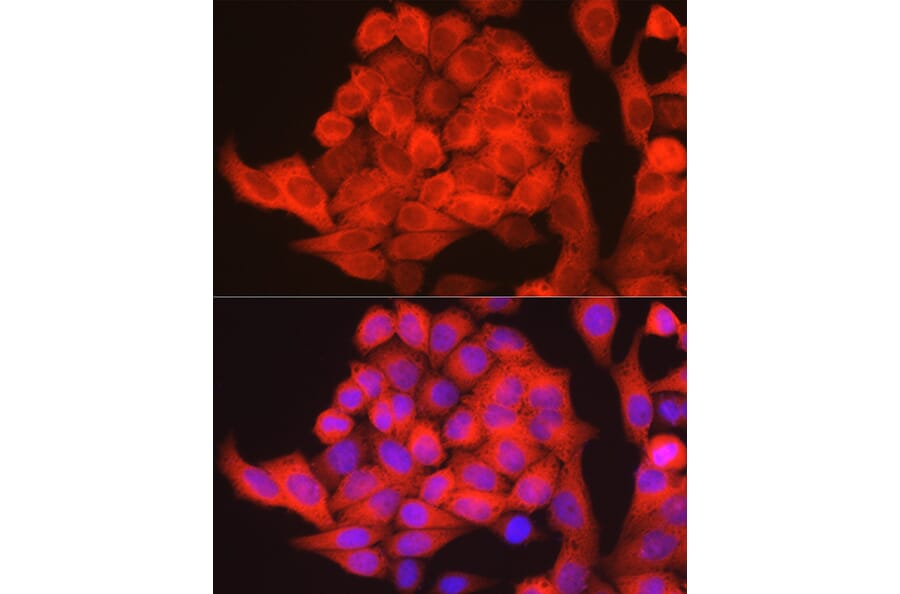Immunofluorescence - Anti-PHGDH/Malate dehydrogenase Antibody (A12950) - Antibodies.com