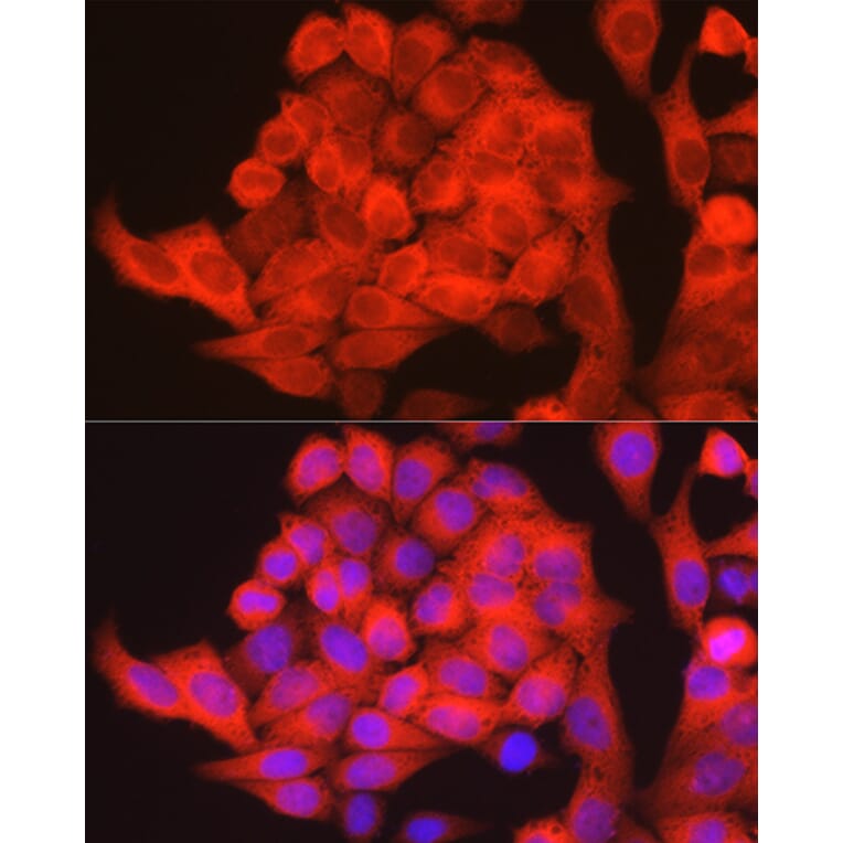 Immunofluorescence - Anti-PHGDH/Malate dehydrogenase Antibody (A12950) - Antibodies.com