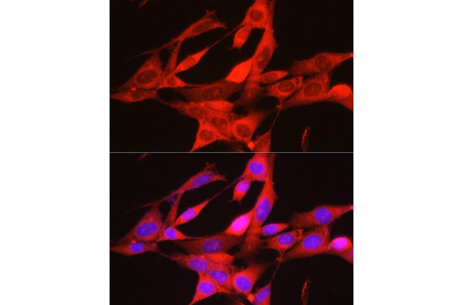 Immunofluorescence - Anti-PHGDH/Malate dehydrogenase Antibody (A12950) - Antibodies.com
