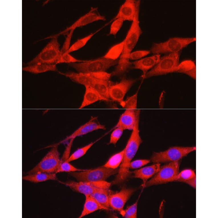 Immunofluorescence - Anti-PHGDH/Malate dehydrogenase Antibody (A12950) - Antibodies.com