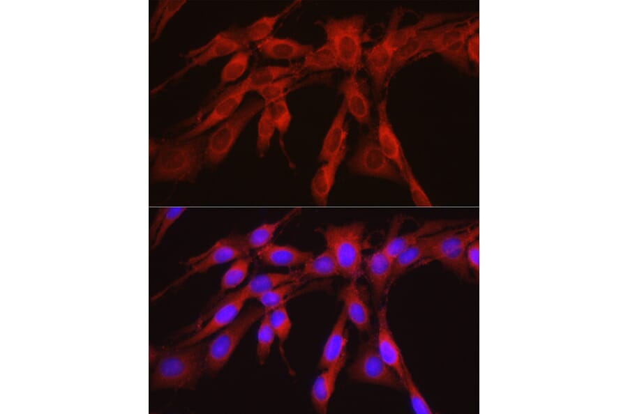 Immunofluorescence - Anti-PHGDH/Malate dehydrogenase Antibody (A12950) - Antibodies.com