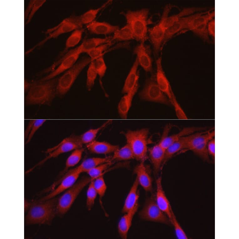 Immunofluorescence - Anti-PHGDH/Malate dehydrogenase Antibody (A12950) - Antibodies.com