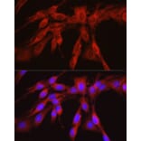 Immunofluorescence - Anti-PHGDH/Malate dehydrogenase Antibody (A12950) - Antibodies.com