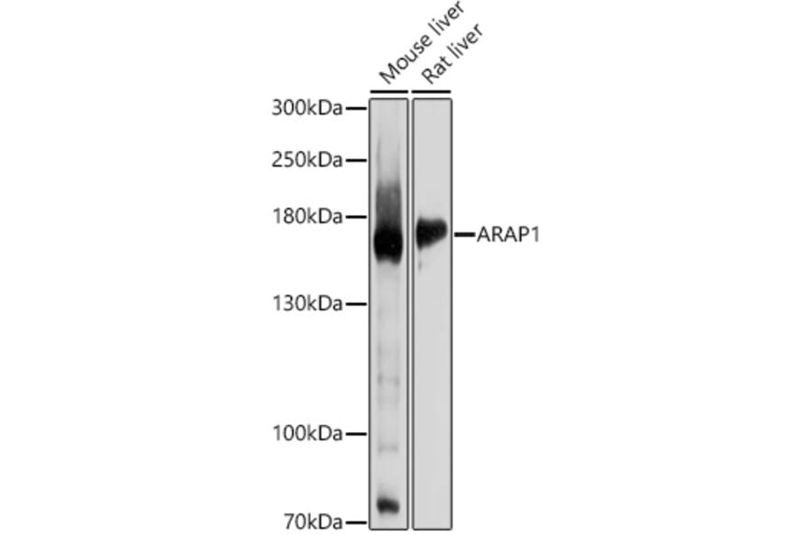 Western Blot - Anti-ARAP1 Antibody (A12951) - Antibodies.com
