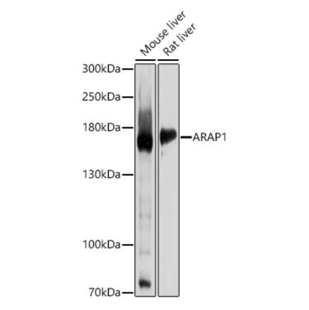 Western Blot - Anti-ARAP1 Antibody (A12951) - Antibodies.com