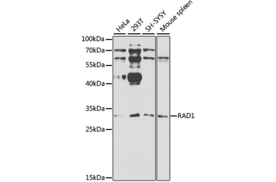 Western Blot - Anti-RAD1 Antibody (A1047) - Antibodies.com