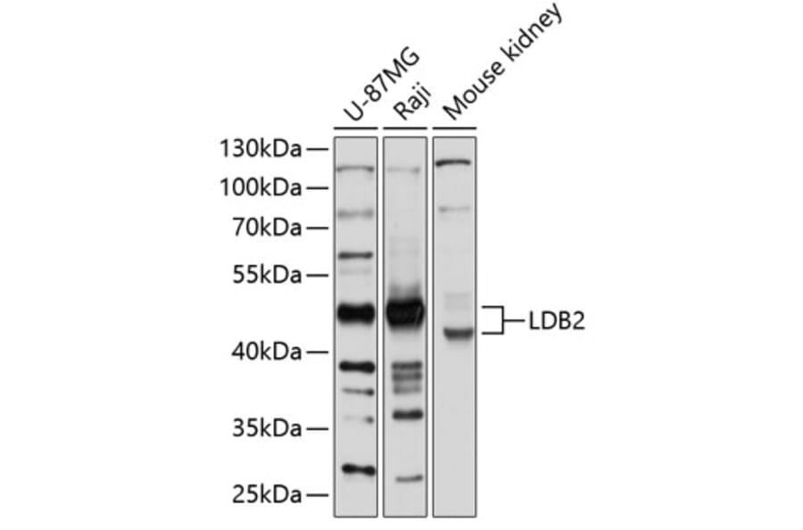 Western Blot - Anti-LDB2 Antibody (A12953) - Antibodies.com