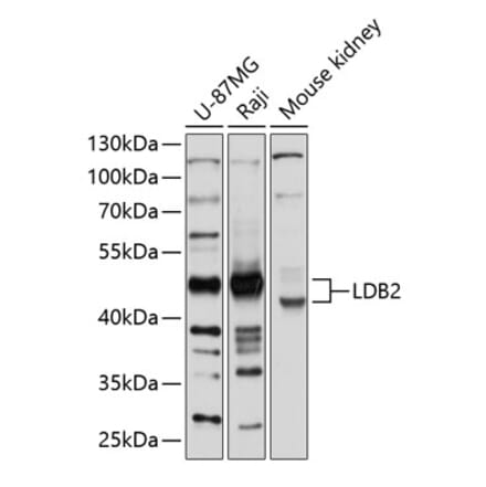 Western Blot - Anti-LDB2 Antibody (A12953) - Antibodies.com