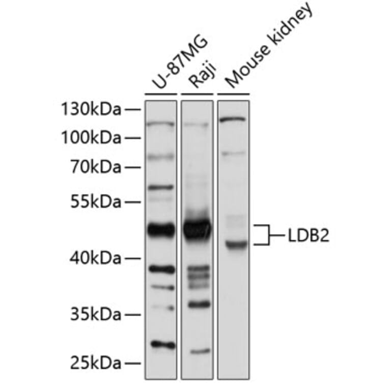 Western Blot - Anti-LDB2 Antibody (A12953) - Antibodies.com