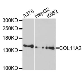 Western Blot - Anti-COL11A2 Antibody (A10473) - Antibodies.com