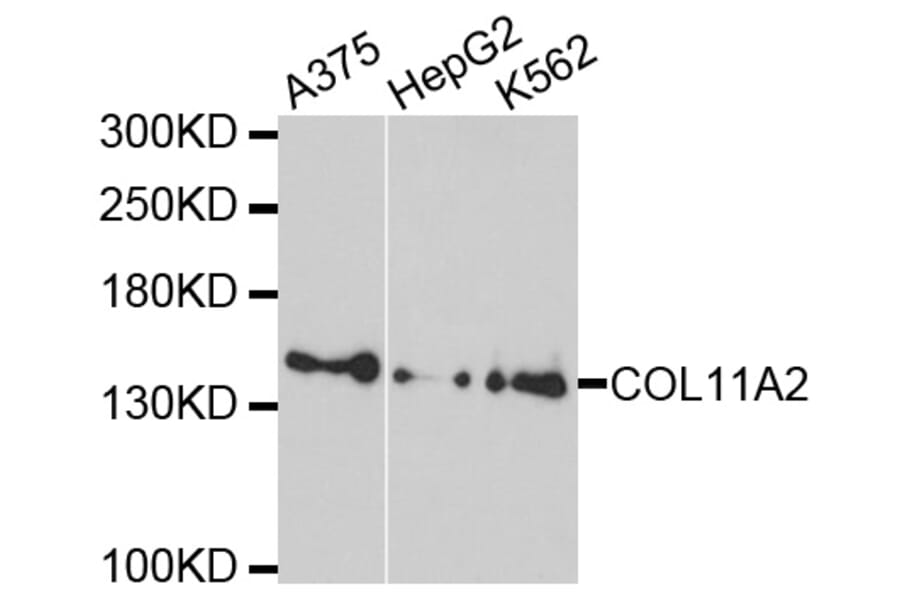 Western Blot - Anti-COL11A2 Antibody (A10473) - Antibodies.com