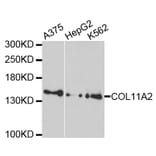 Western Blot - Anti-COL11A2 Antibody (A10473) - Antibodies.com