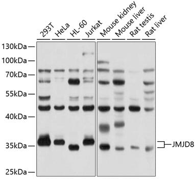 Western blot analysis of extracts of various cell lines, using Anti-JMJD8 Antibody (A10476) at 1:1,000 dilution.
Secondary antibody: Goat Anti-Rabbit IgG (H+L) (HRP) (AS014) at 1:10,000 dilution.
Lysates / proteins: 25µg per lane.
Blocking buffer: 3% non-fat dry milk in TBST.
Detection: ECL Basic Kit (RM00020).
Exposure time: 3s.