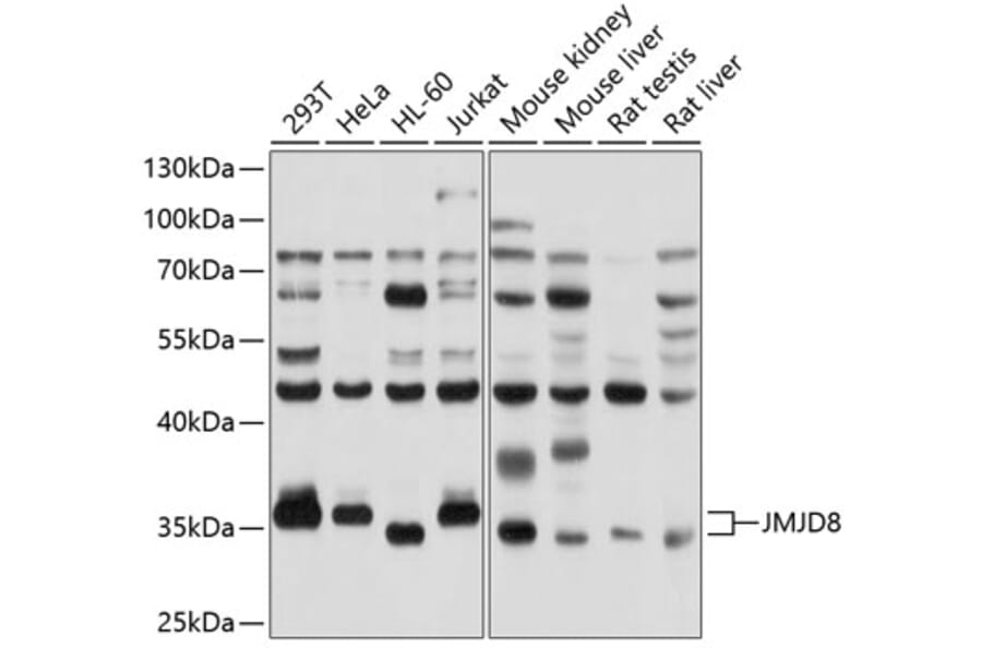 Western Blot - Anti-JMJD8 Antibody (A12955) - Antibodies.com