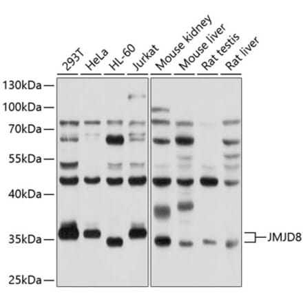 Western Blot - Anti-JMJD8 Antibody (A12955) - Antibodies.com