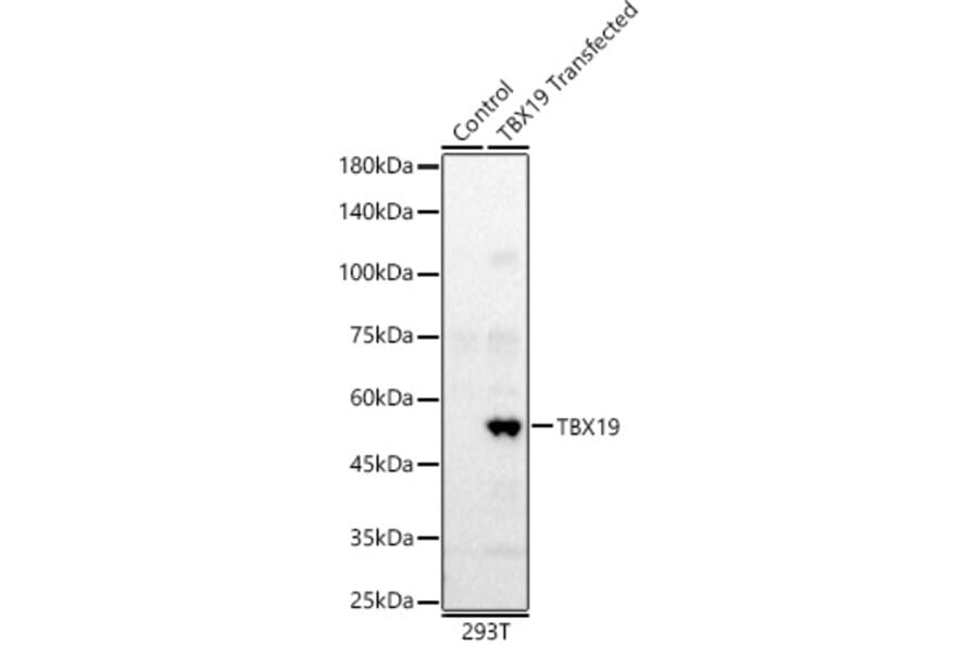Western Blot - Anti-Tpit Antibody (A12956) - Antibodies.com
