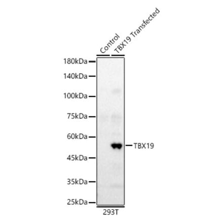 Western Blot - Anti-Tpit Antibody (A12956) - Antibodies.com