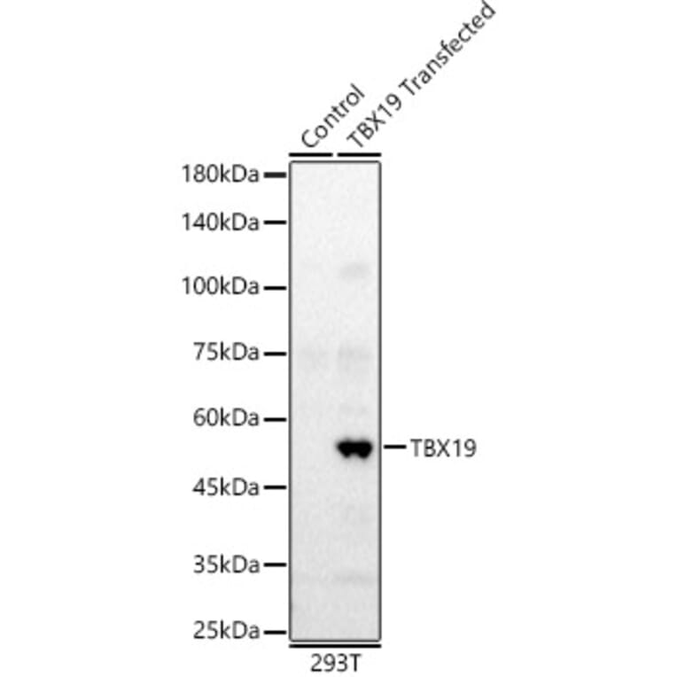 Western Blot - Anti-Tpit Antibody (A12956) - Antibodies.com