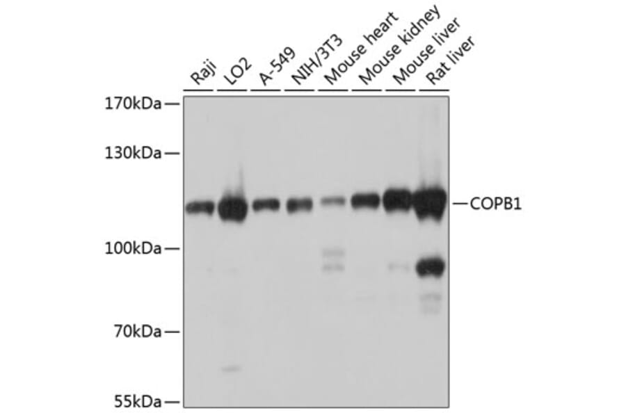 Western Blot - Anti-beta COP Antibody (A12957) - Antibodies.com