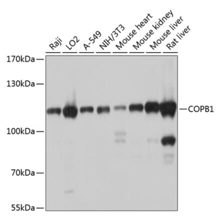 Western Blot - Anti-beta COP Antibody (A12957) - Antibodies.com