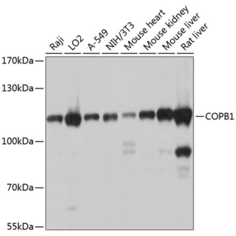 Western Blot - Anti-beta COP Antibody (A12957) - Antibodies.com