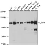 Western Blot - Anti-beta COP Antibody (A12957) - Antibodies.com