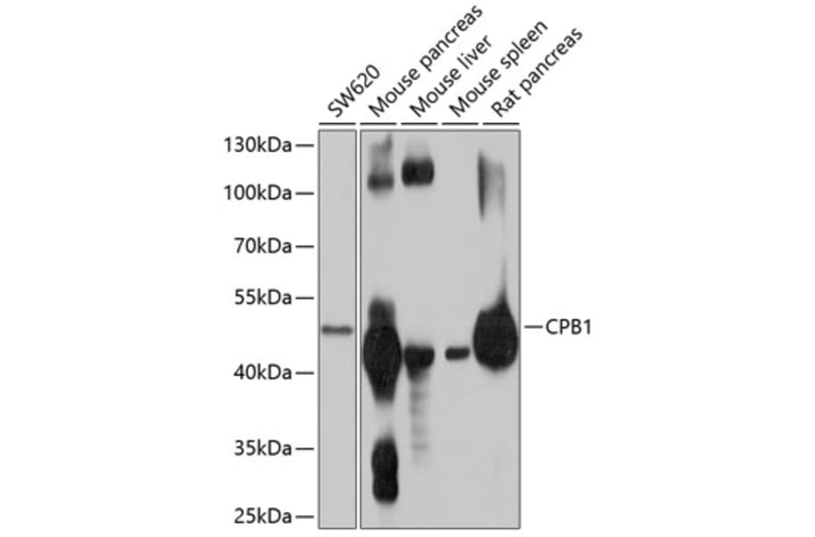 Western Blot - Anti-Carboxypeptidase B/CPB Antibody (A12958) - Antibodies.com