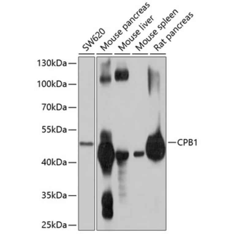Western Blot - Anti-Carboxypeptidase B/CPB Antibody (A12958) - Antibodies.com