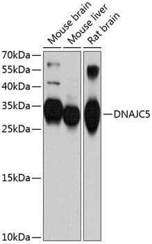Western blot analysis of extracts of various cell lines, using Anti-DNAJC5 Antibody (A10489) at 1:1,000 dilution.
Secondary antibody: Goat Anti-Rabbit IgG (H+L) (HRP) (AS014) at 1:10,000 dilution.
Lysates / proteins: 25µg per lane.
Blocking buffer: 3% non-fat dry milk in TBST.
Detection: ECL Basic Kit (RM00020).
Exposure time: 90s.
