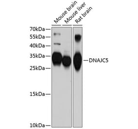 Western Blot - Anti-CSP Antibody (A12959) - Antibodies.com