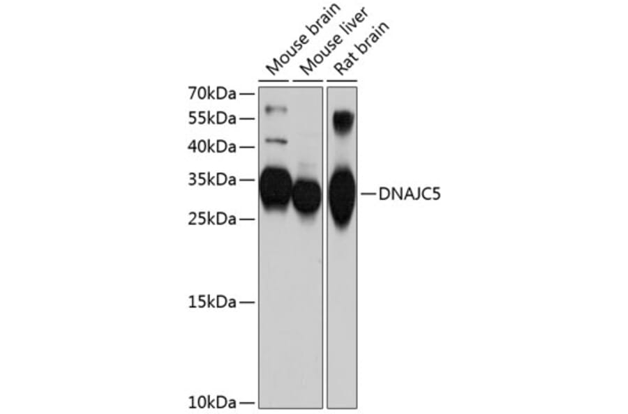 Western Blot - Anti-CSP Antibody (A12959) - Antibodies.com