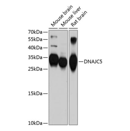 Western Blot - Anti-CSP Antibody (A12959) - Antibodies.com