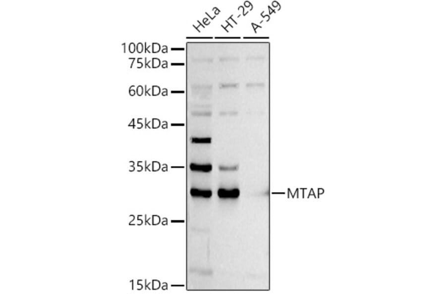 Western Blot - Anti-MTAP Antibody (A12960) - Antibodies.com