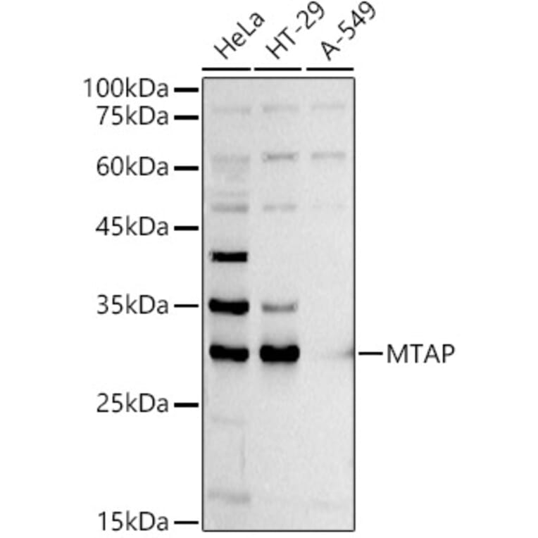 Western Blot - Anti-MTAP Antibody (A12960) - Antibodies.com