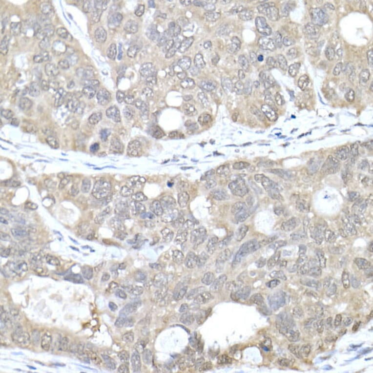 Immunohistochemistry - Anti-MTAP Antibody (A12960) - Antibodies.com