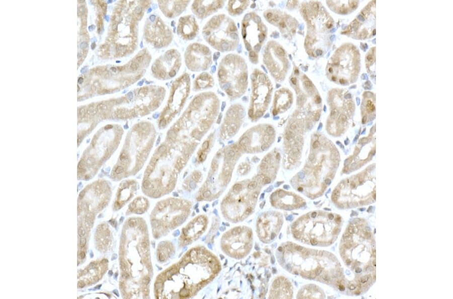 Immunohistochemistry - Anti-MTAP Antibody (A12960) - Antibodies.com