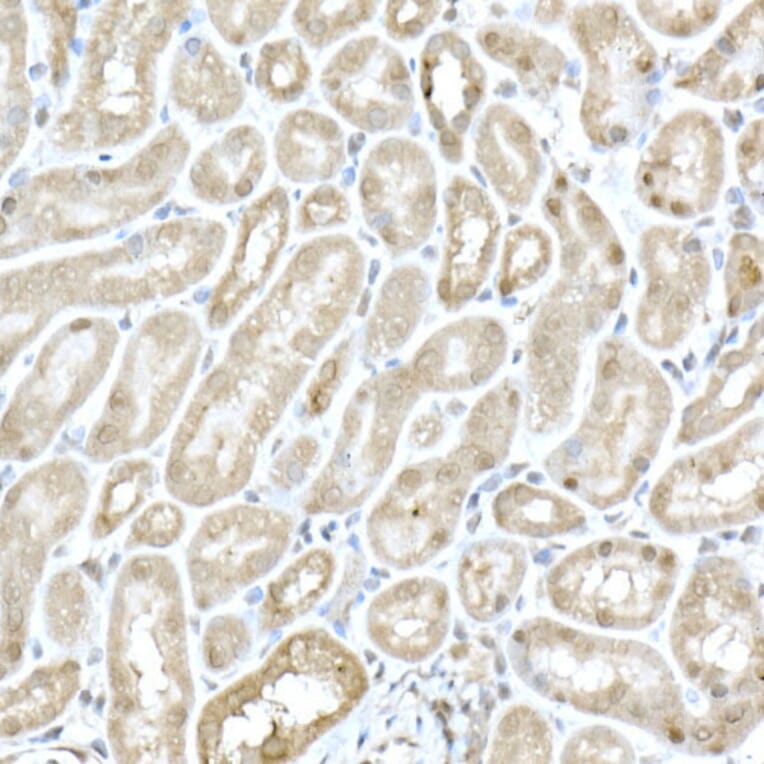 Immunohistochemistry - Anti-MTAP Antibody (A12960) - Antibodies.com